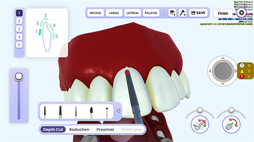 牙医模拟器安卓版